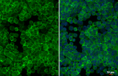 Anti-GPR132 antibody [HL4946] used in Immunocytochemistry/ Immunofluorescence (ICC/IF). GTX645019